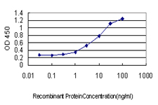 E - UCHL3 Antibody (monoclonal) (M01) AT4456a